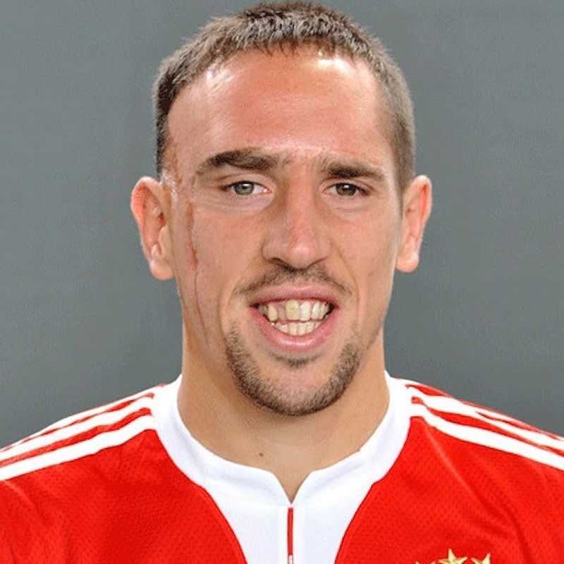 Frank Ribéry - cầu thủ xấu trai