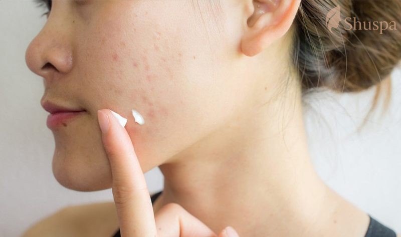 Cách chăm sóc đơn giản và hiệu quả chính là tẩy tế bào chết