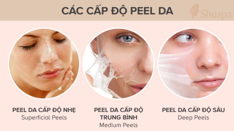 Các cấp độ peel da cần tham khảo khi tìm hiểu peel da là gì?