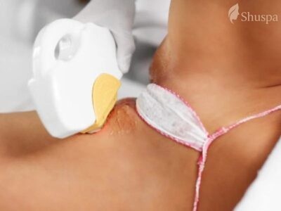 Sẽ có nhiều hiện tượng da sau khi triệt lông cần phải quan sát và theo dõi để tránh tác dụng phụ không mong muốn