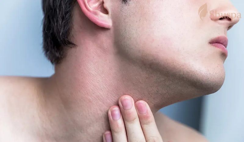 Kích ứng da là một trong những hiện tượng phổ biến đối với nam giới