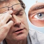 Giật lông mày trái cũng có thể là nguyên nhân về các tình trạng mắt