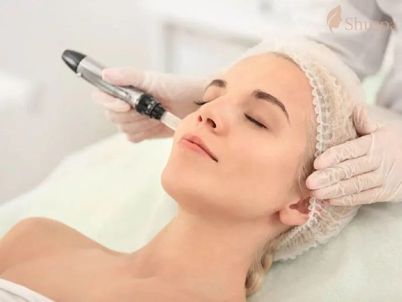 Một số vấn đề cần chú ý về chăm sóc da sau laser