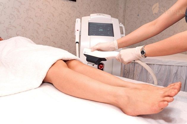 Công nghệ triệt lông laser thế hệ mới đang được ứng dụng nhiều hơn trong ngành làm đẹp
