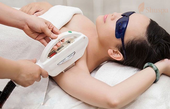 Công nghệ triệt lông bằng laser là một trong những phương pháp triệt lông được ưa chuộng