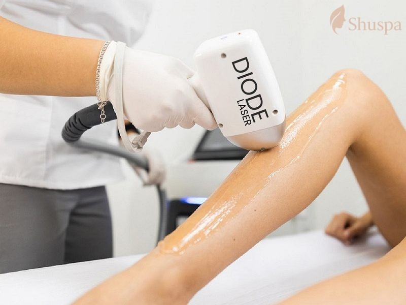 Nguyên lý hoạt động của diode laser và cách sử dụng