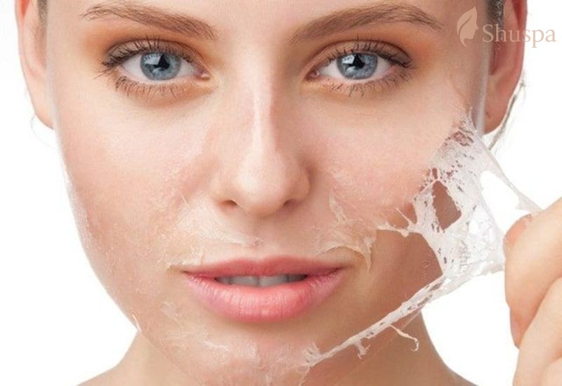 Có nhiều loại peel da với mức độ khác nhau tùy thuộc vào tình trạng da của mỗi người
