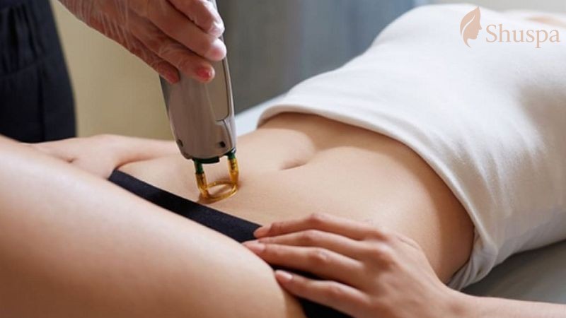 Đàn ông có thích phụ nữ triệt lông vùng kín?