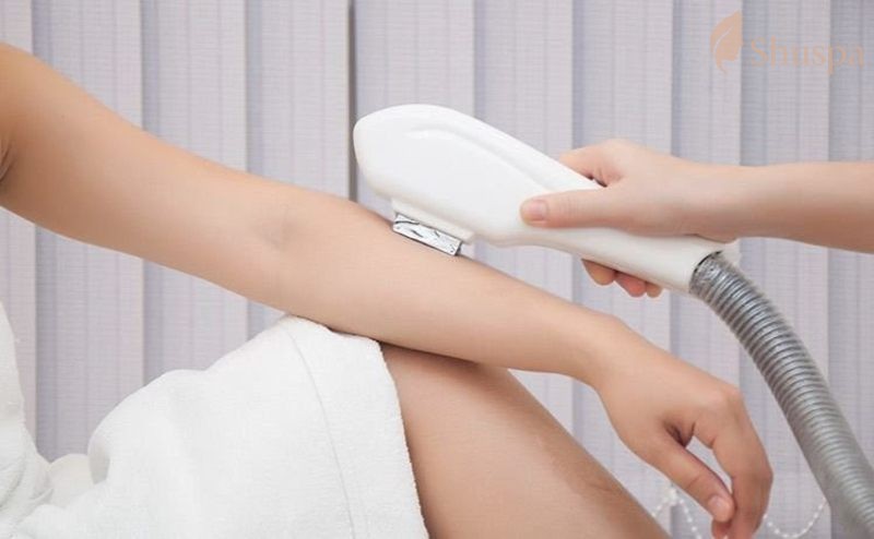 Quy trình chuẩn đối với triệt lông diode laser 