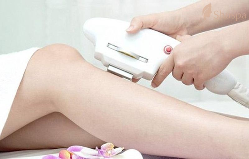 Hiệu quả của triệt lông diode laser trên vùng da mặt và cổ
