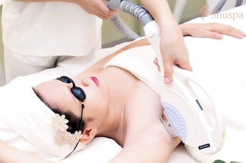 Một số vấn đề cần chăm sóc sau khi triệt lông diode laser 