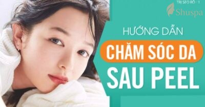 Chăm sóc da sau peel sẽ giúp làn da sáng và khoẻ mạnh hơn